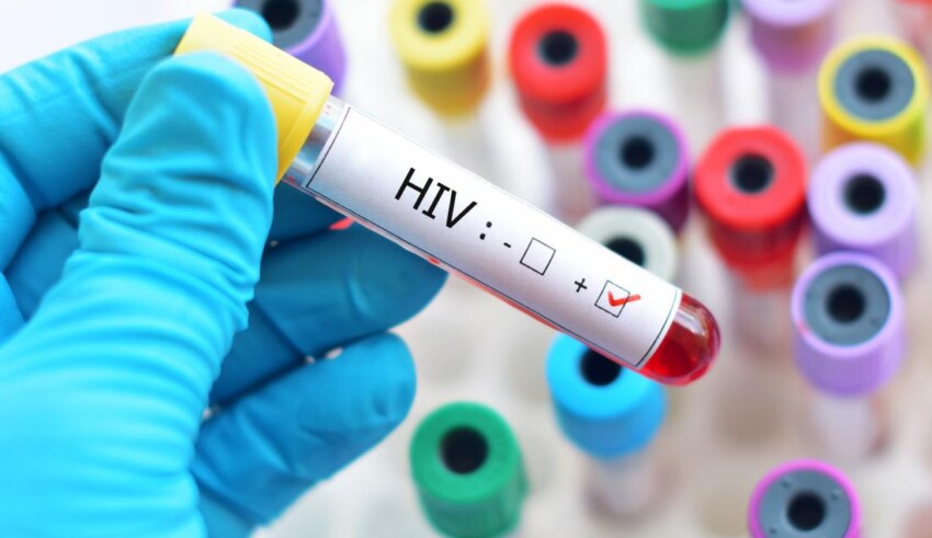Co warto wiedzieć o HIV Pierwsze objawy HIV